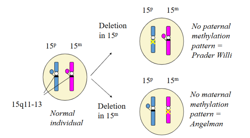 <p>• Deletion from paternal Chr 15 = Prader Willi</p><p>• Deletion from maternal Chr 15 = Angelman</p>