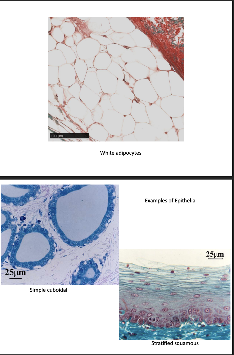 <ol><li><p>Connective tissue→ pics</p></li></ol><p></p>