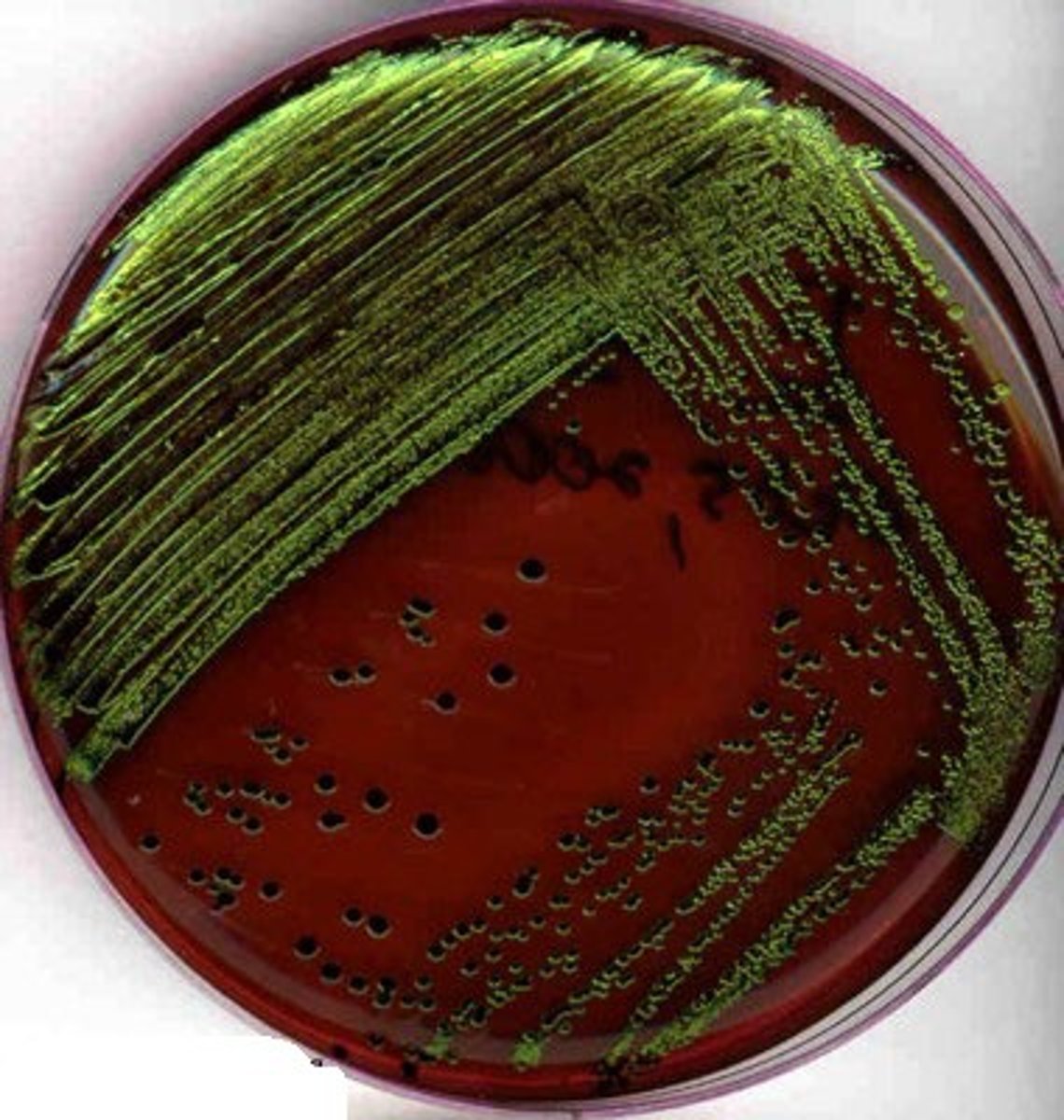 <p>which test is displayed in the picture?</p>