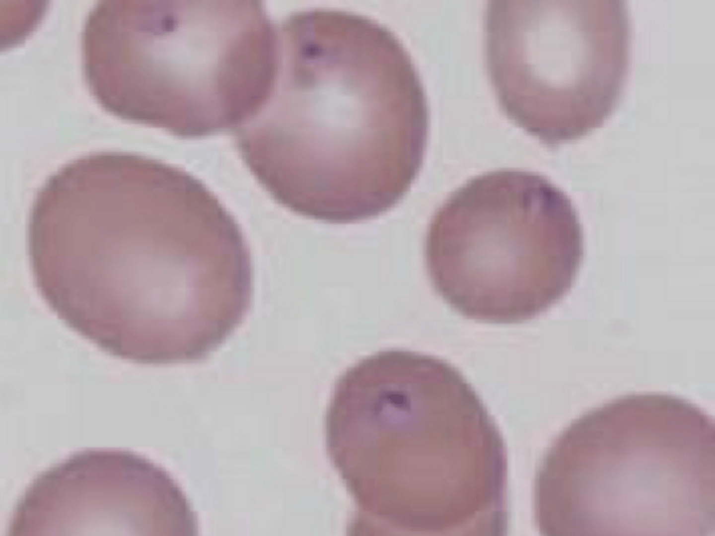 <p>What is the following parasite></p>