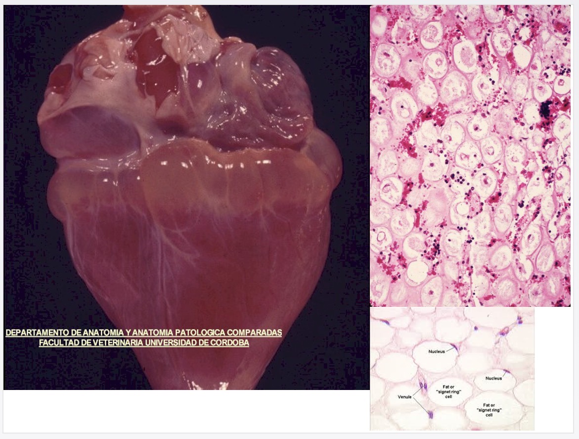 <p>transformation of white/yellow epicardial fat deposits into grey gelatinous material </p>