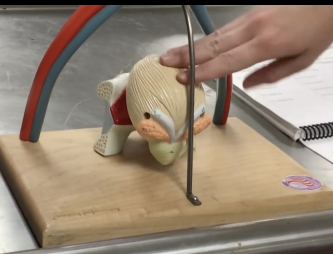 <p>Description: Visceral peritoneum covering the roof of the urinary bladder</p><p>Relationship: N/A</p>