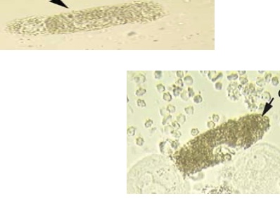 term image
