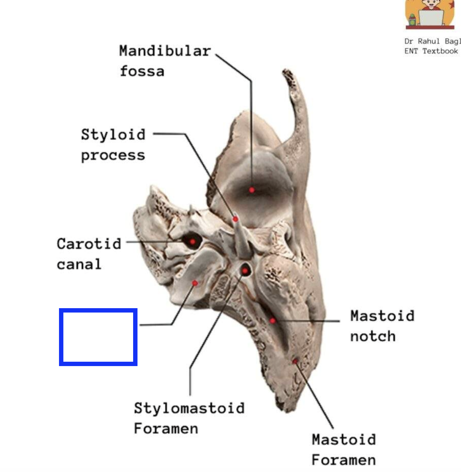 <p>located just medial to the base of the styloid fossa, deep fossa (blue box in image)</p>
