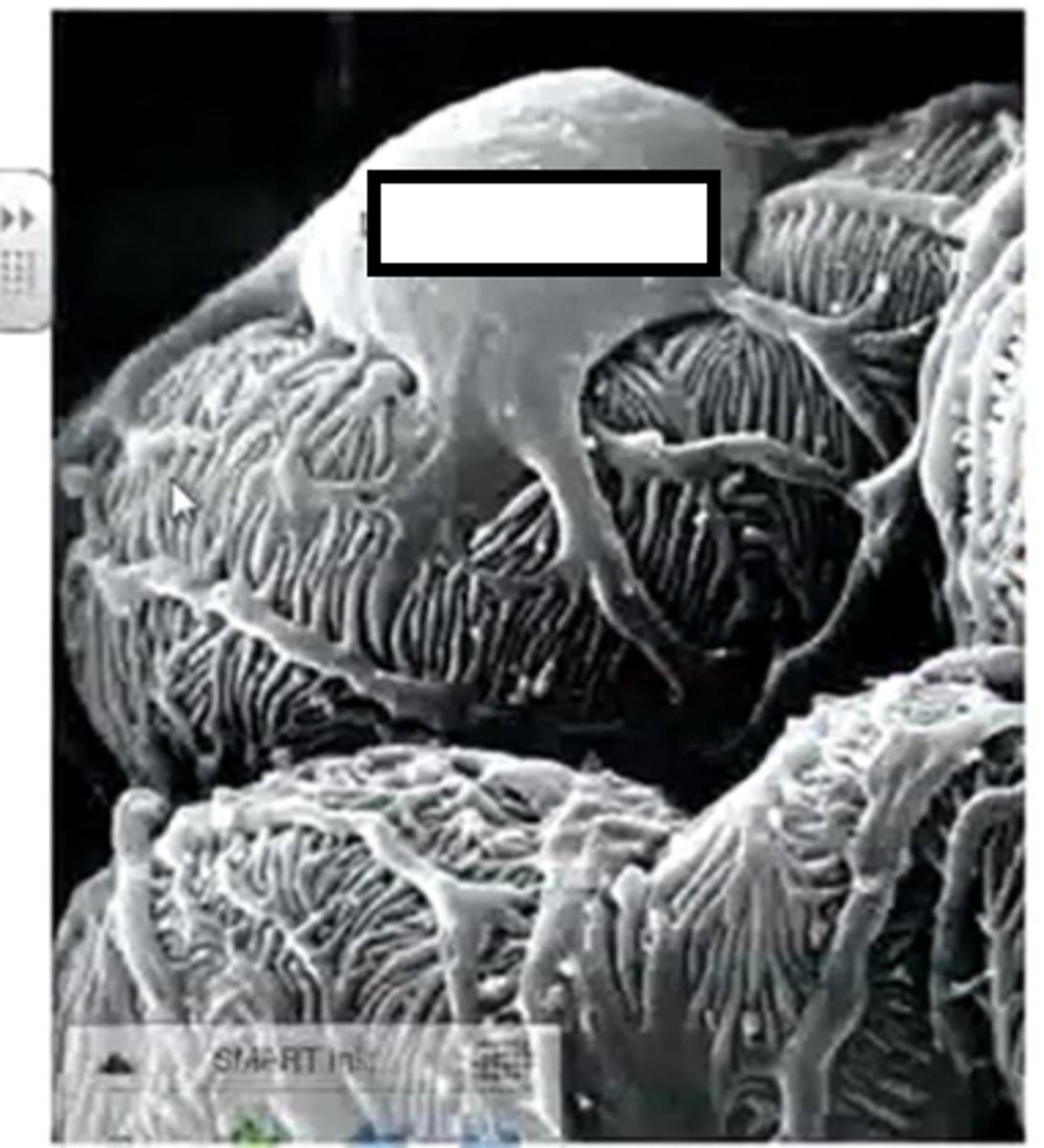 <ul><li><p>Specialised cells</p></li><li><p>Finger like projections (pedicels) that wrap around the capillaries to ensure any cells, platelets, or large plasma proteins that have managed to get through the epithelial cells and the basement membrane do not get in the tubule itself.</p></li></ul><p></p>