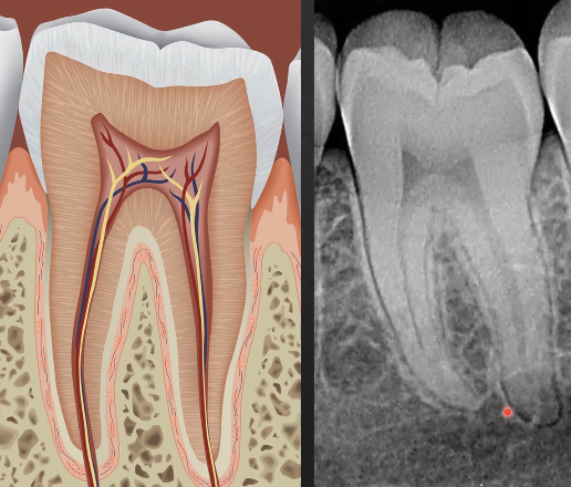 <p>what can we determine from this radiograph?</p>