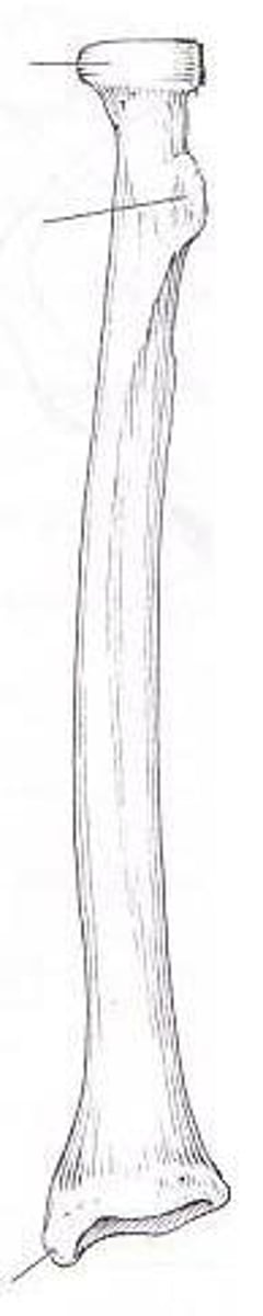 <p>ID bone</p>