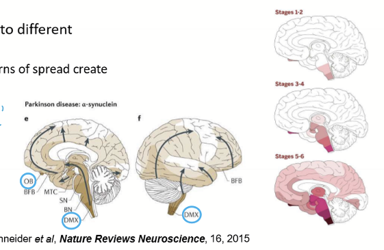 <p>It spreads to the Dorsal Motor Nucleus (DMX) of Vagus, then to the midbrain. Eventually, it affects the substancia nigra pars compatca of the midbrain </p>