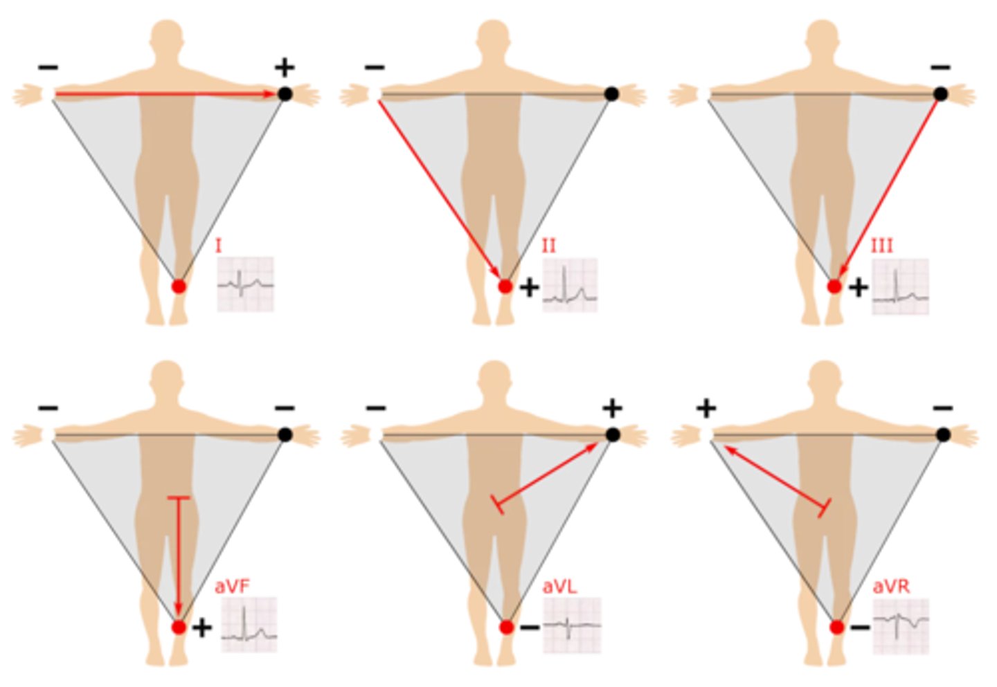 <p>Direction of depolarization as it passes through the heart; lead I &amp; lead aVF (since normal conduction goes down &amp; to the left)</p>