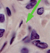 <p>Squamous epithelial tissue has a very <strong>flat, thin, and scale-like, </strong>broad, with irregular edges, and with a central, flattened nucleus.</p>