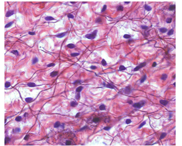 <p>under skin, around organs, supports epithelium </p>