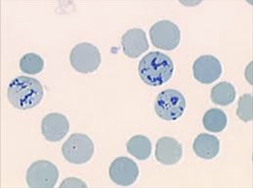 <p>what is this an example of (*hint: in supravital stain)?</p>