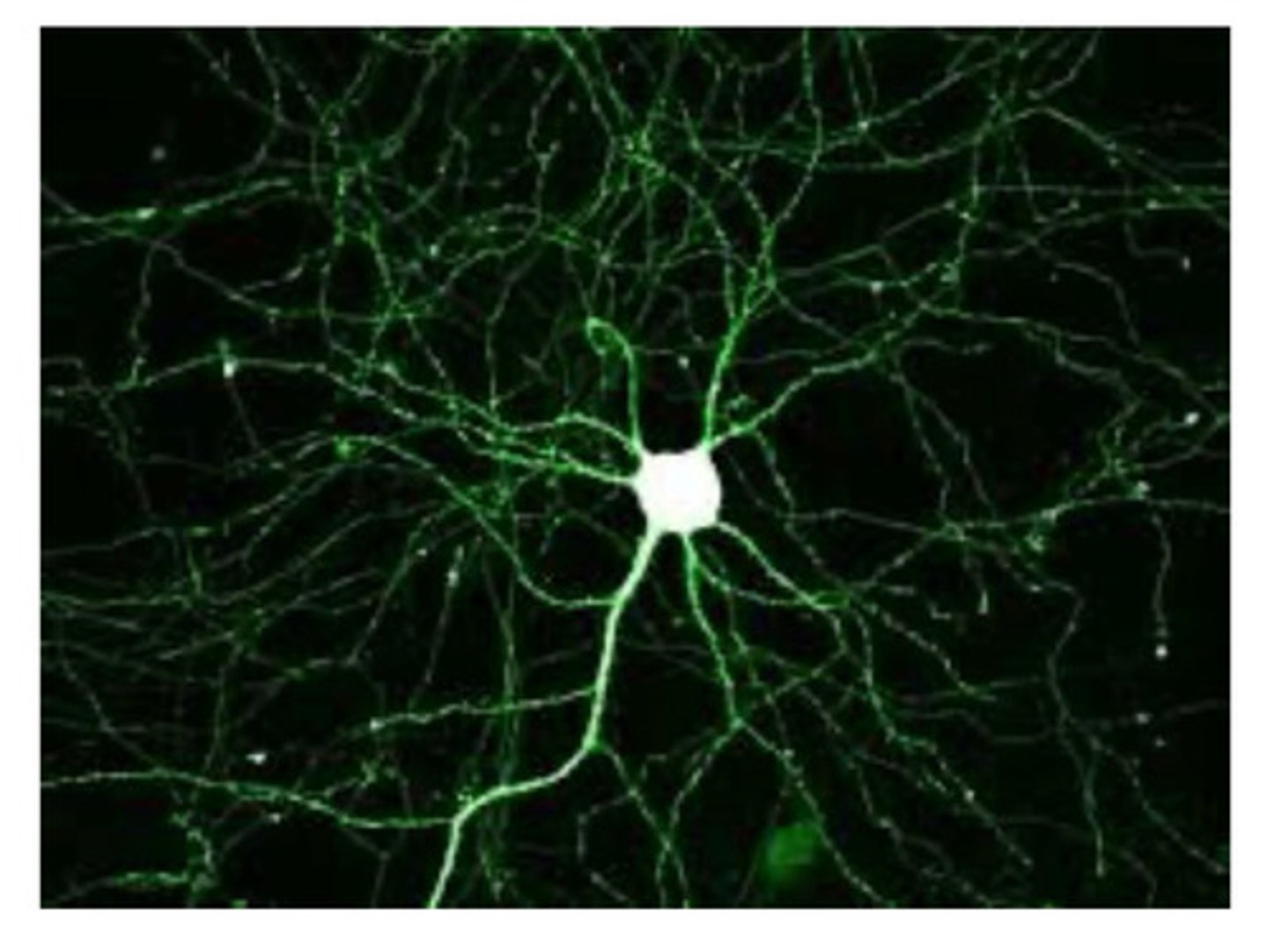 <p>Fluorescent protein, used to visualize neurons</p>