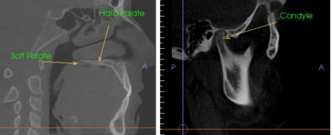 <p>What CBCT view is presented, and what type of contrast is shown on the right ?</p>