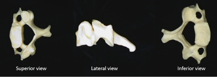 which region does this vertebra originate. 