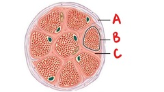 Perimysium (A), Muscle fiber (B), and Endomysium (C)