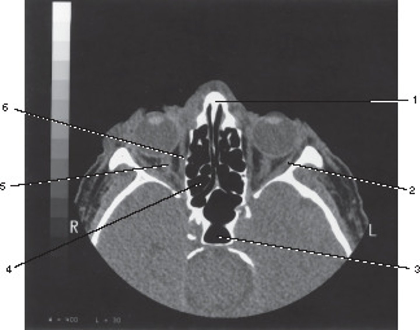 <p>Number 2 corresponds to which of the following?</p>
