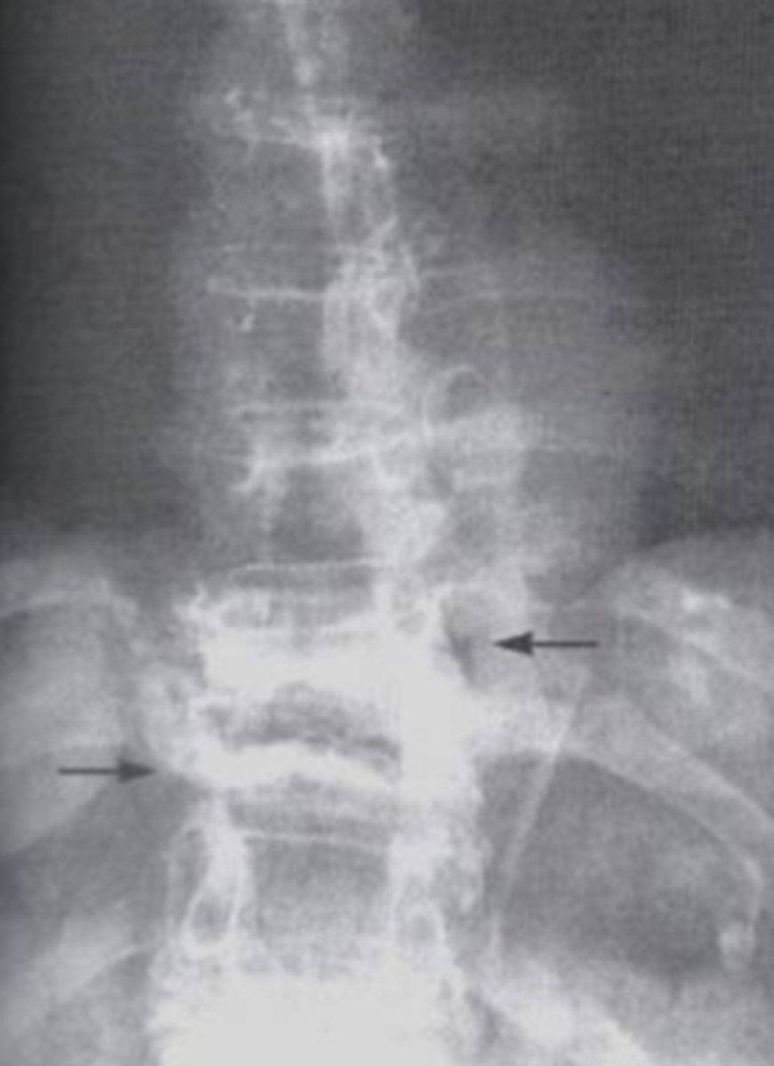 <p>What is the issue?</p>