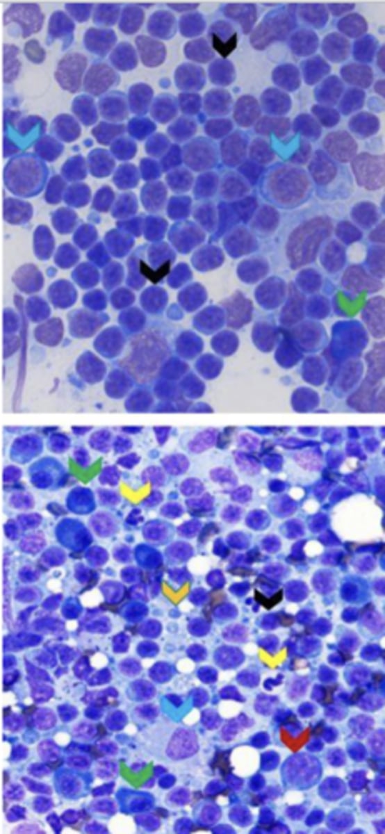 <p>What term is used for this increased number of cells?</p>