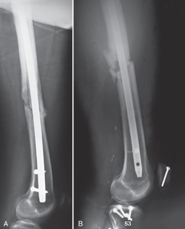 <ul><li><p>structures shown:</p><ul><li><p>distal 2/3 of femur</p></li><li><p>knee joint</p></li><li><p>no superimposition of opposite thigh</p></li></ul></li><li><p>evaluation criteria:</p><ul><li><p>most of femur with knee joint</p></li><li><p>patella in profile</p></li><li><p>superimposition of femoral condyles</p></li><li><p>oppposite femur and soft tissue out of area of interest</p></li><li><p>adequate penetration of proximal femur</p></li><li><p>orthopedic appliance if present</p></li></ul></li></ul><p></p>