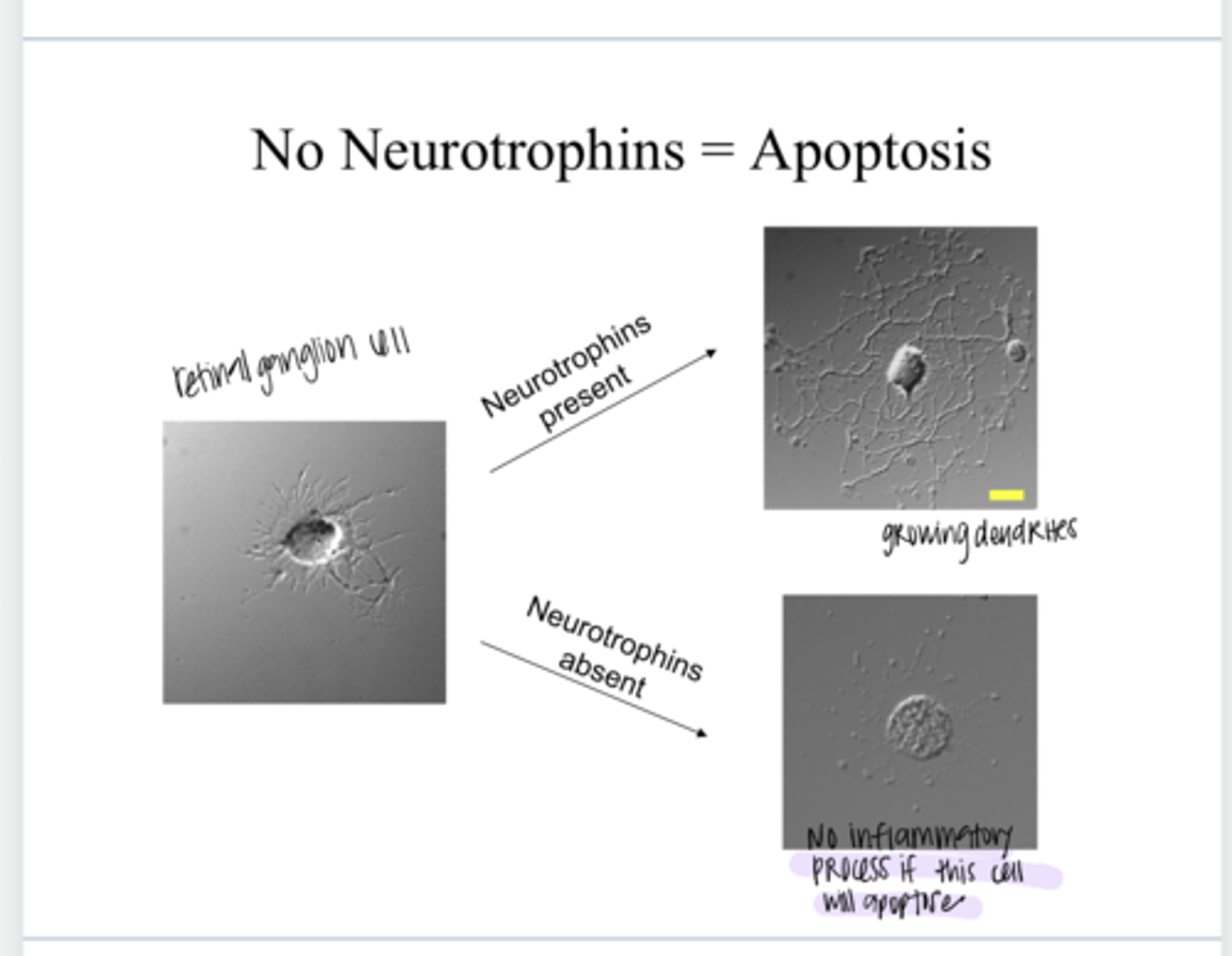 <p>No Neurotrophins = Apoptosis</p><p>Neurotrophins Present = RGC Growth (Pic)</p>