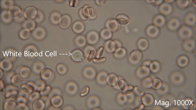 <p>Hypo, Hyper, Isotonic?</p>