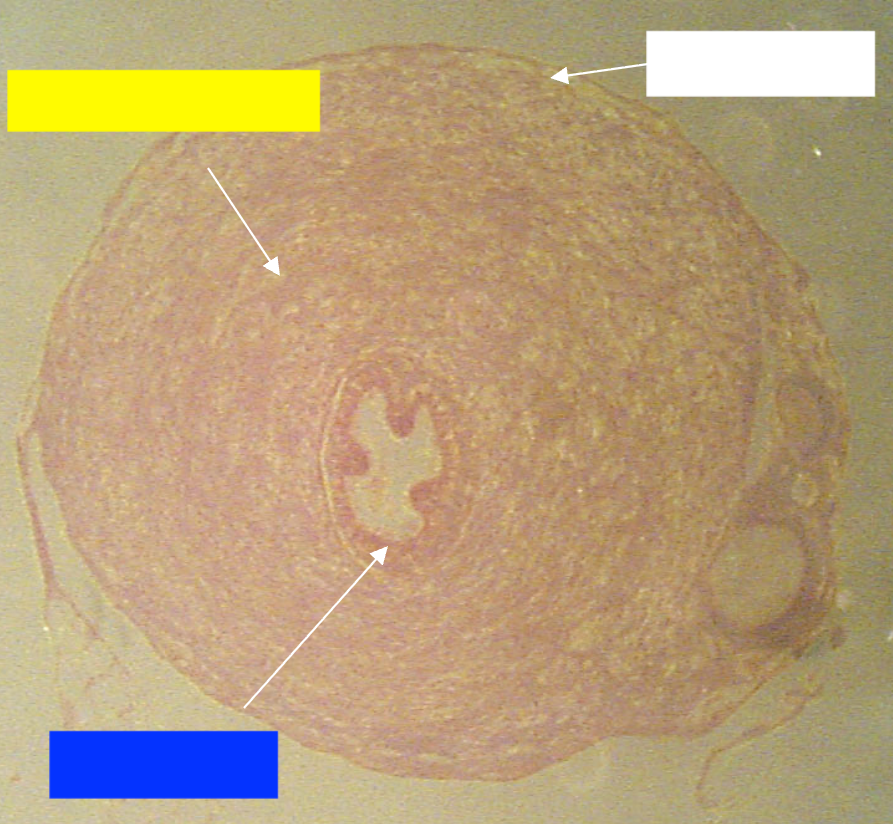 <p>Which layer of the vas deferens is being indicated by the yellow box?</p>