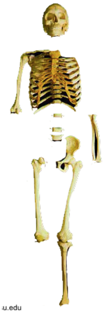 <p><span>What bones are missing from this individual? </span></p>