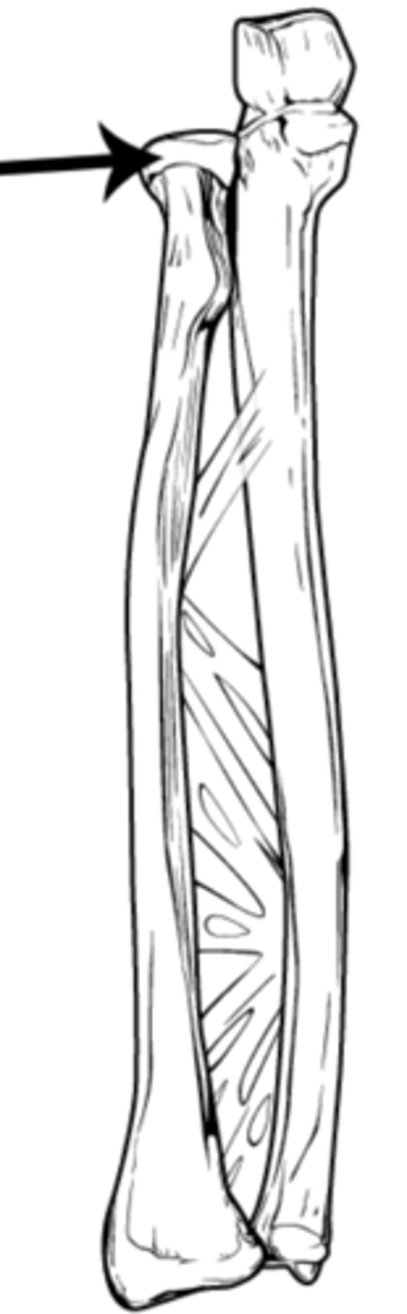 <p>a disc-shaped, proximal bone structure in the forearm that articulates with the humerus and ulna, crucial for elbow stability and forearm rotation (pronation/supination)</p>