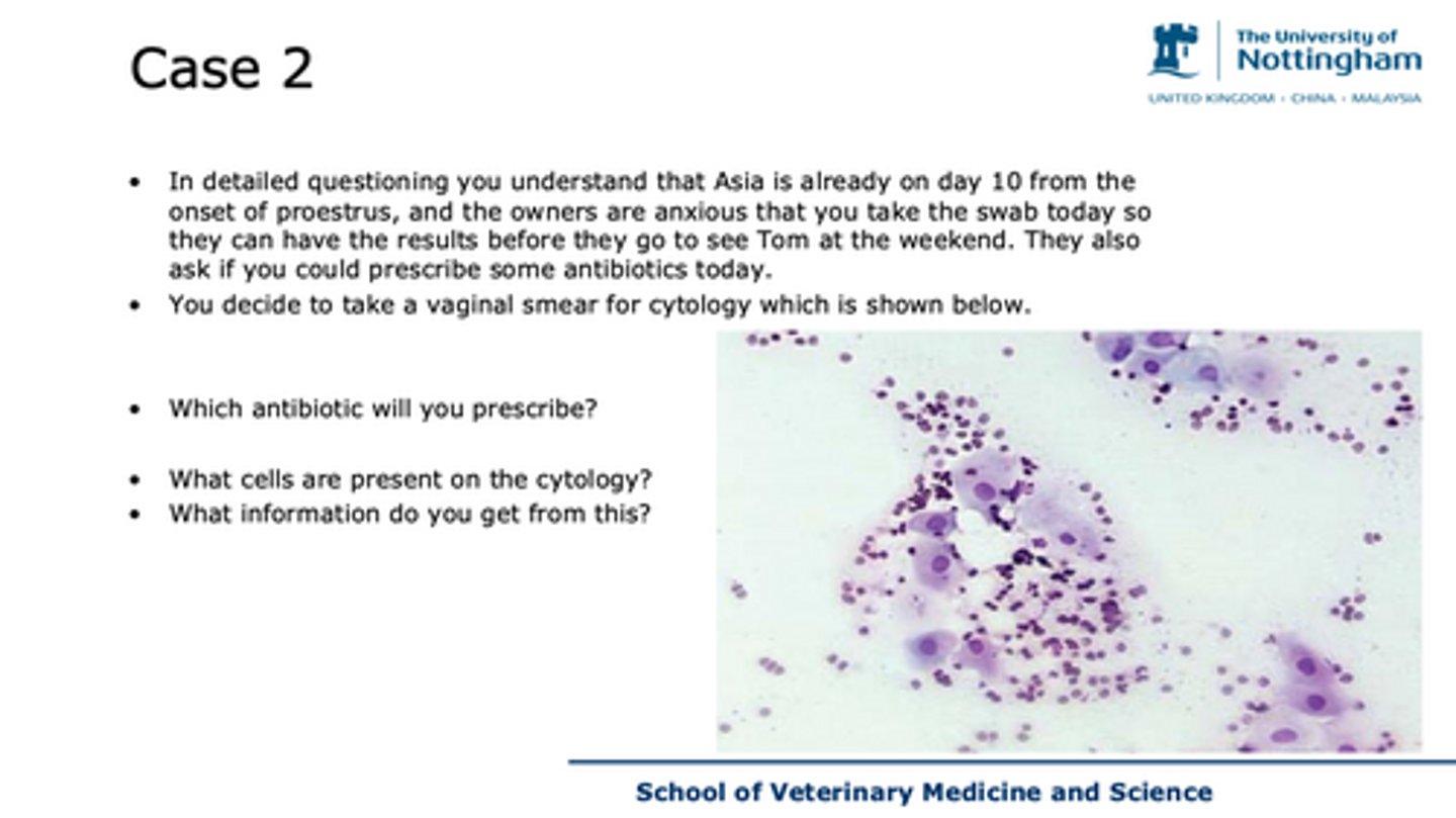 <p>case 2</p><p>which antibiotic will you prescribe?</p><p>what cells are present?</p><p>what information does this give you?</p>
