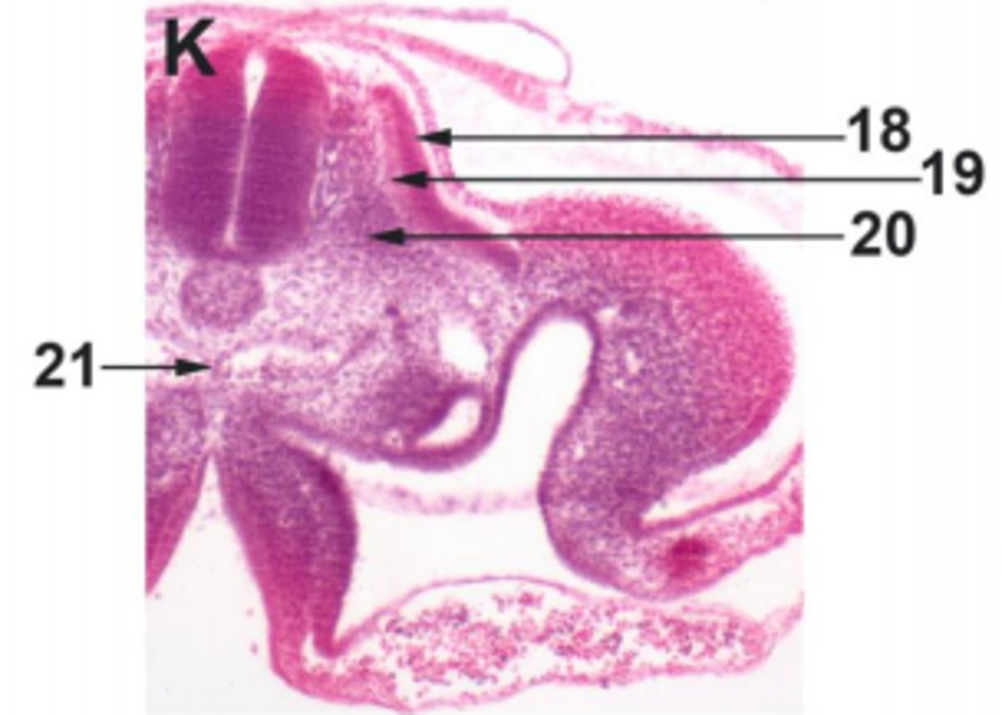 <p>#20 mesoderm</p>