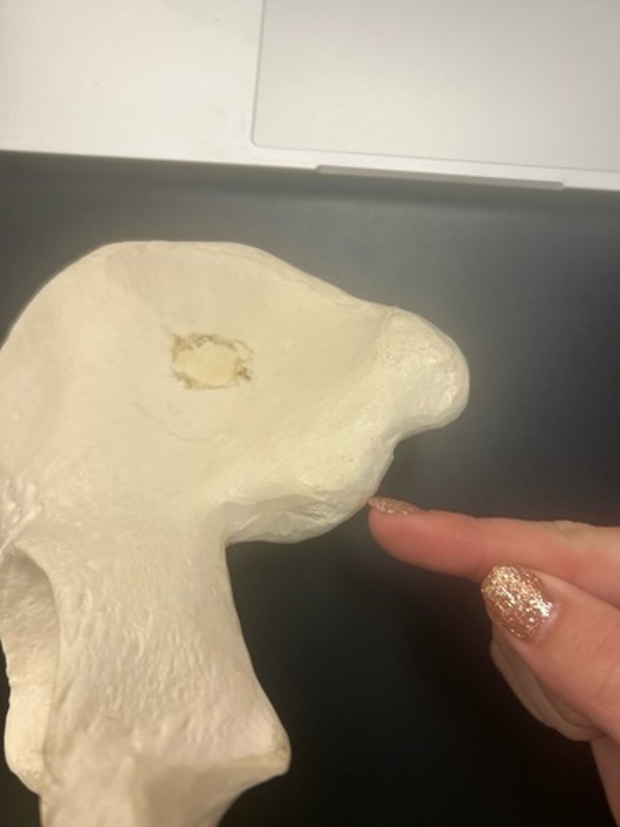 <p>name the bone</p>