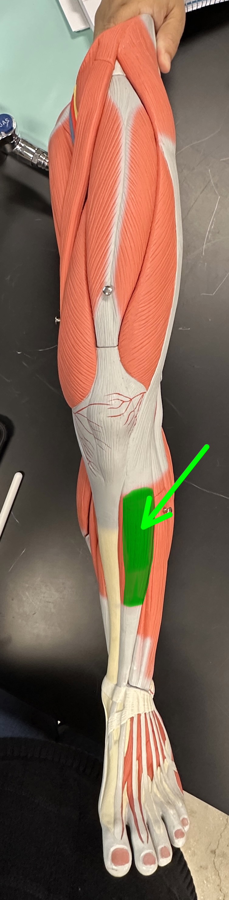 <p>What is the highlighted structure</p>