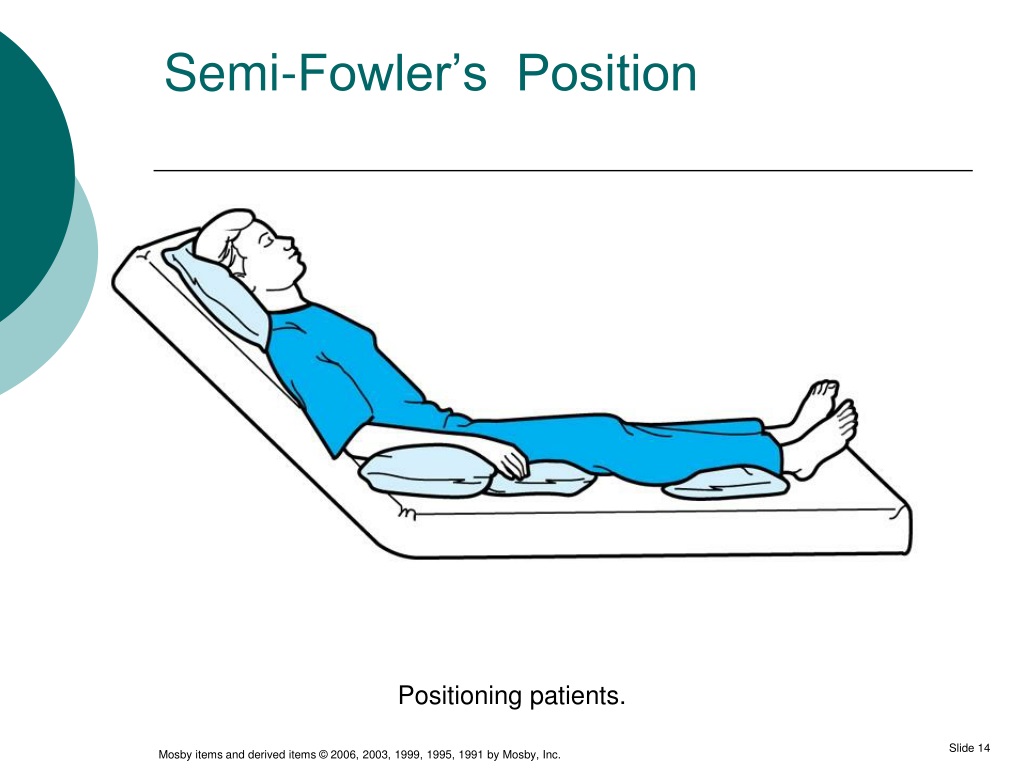 <p>mid fowler (semi fowler)</p>