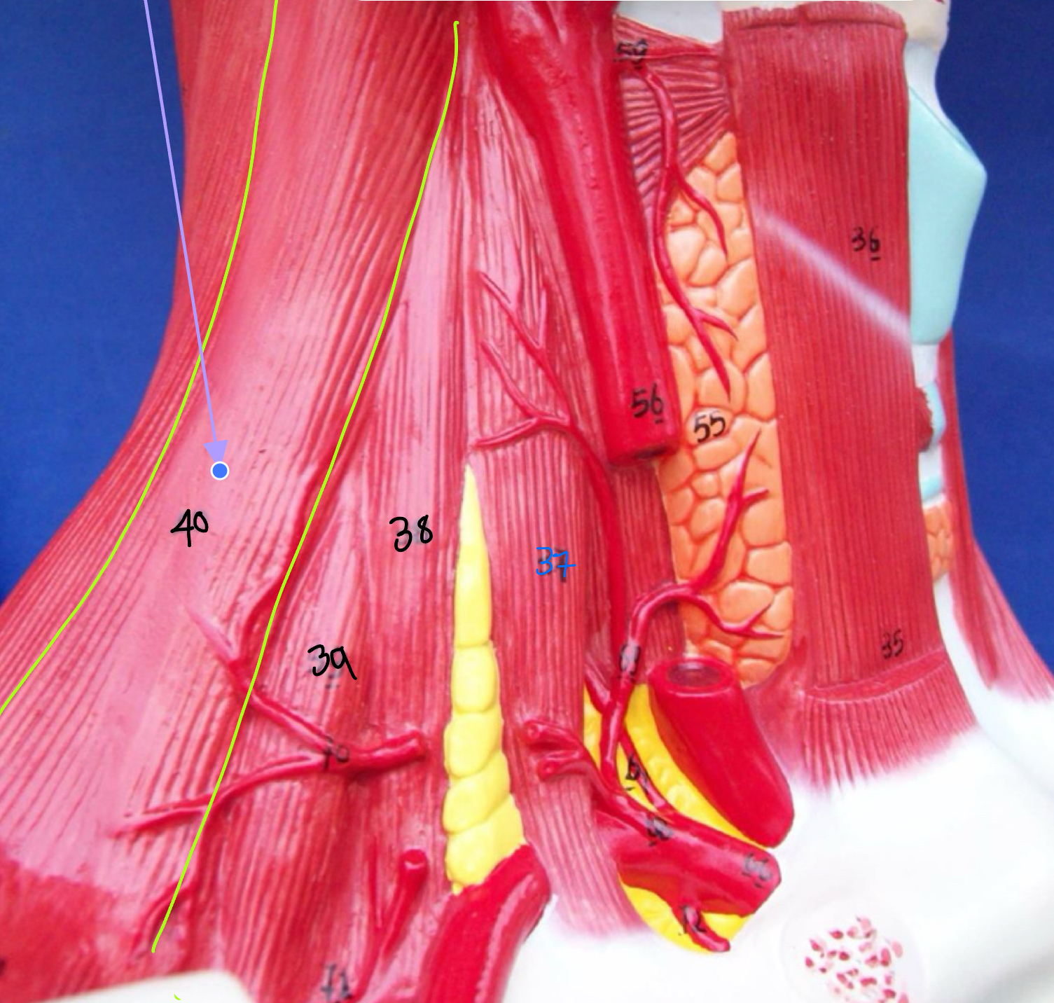<p>What type of muscle is this ( altay model )</p>