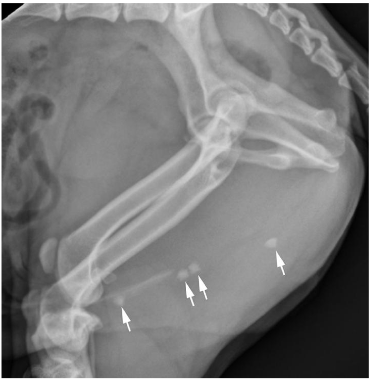<p>What organ is obstructed by the calculi?</p>