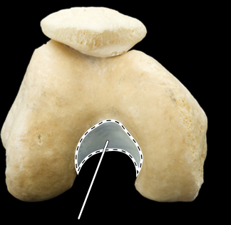 <p>Articulated right femur and patella, inferior view</p>