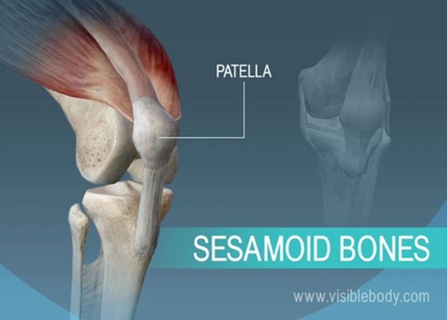 <p>small, round bone embedded in a tendon; protects the tendon from compressive forces</p><p>patella</p>
