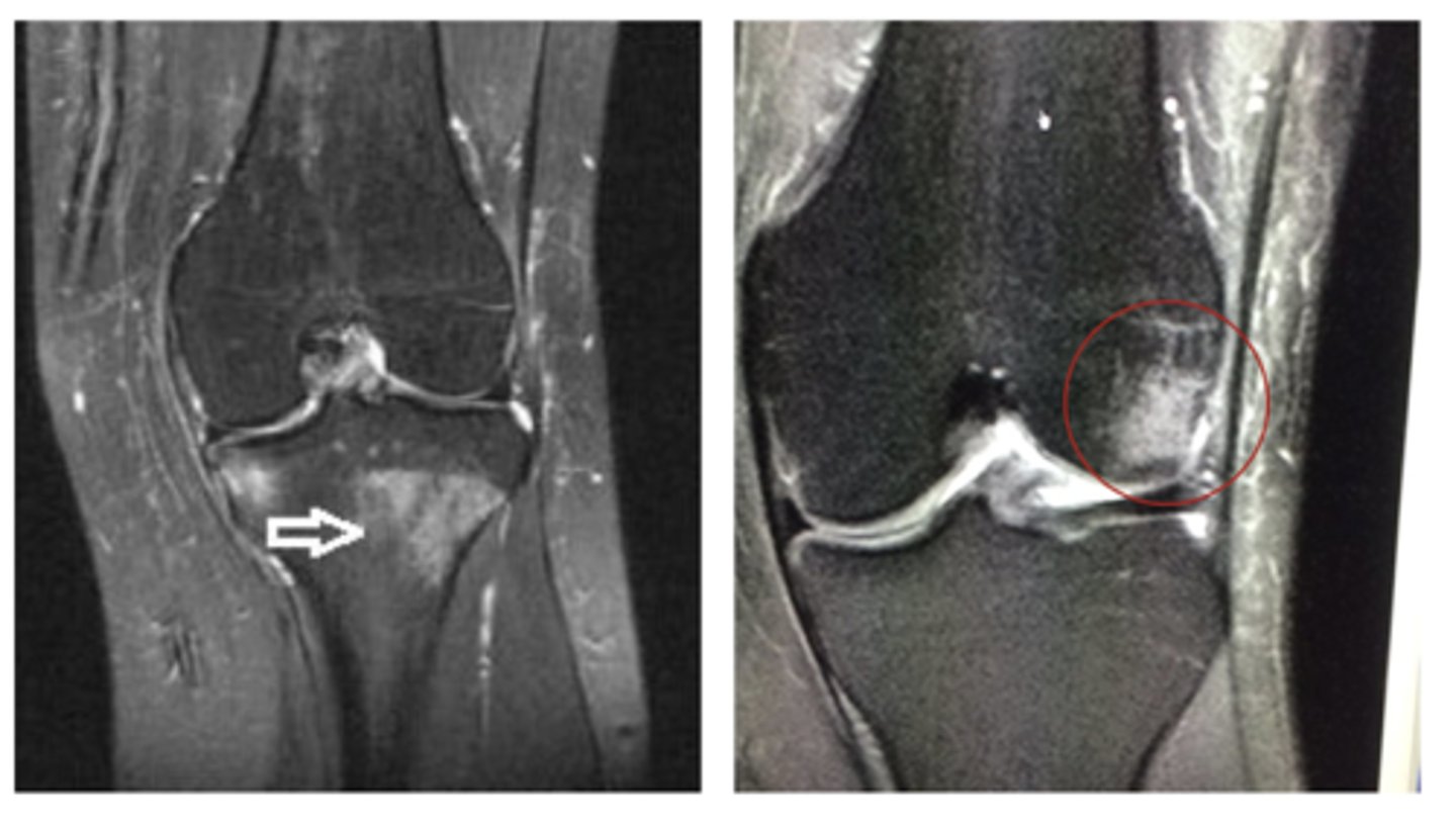<p>Define the pathology.</p>