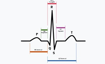 <ul><li><p>vlna P = depolarizace síní</p></li><li><p>kmit QRS = depolarizace komor, repolarizace síní</p></li><li><p>vlna T = repolarizace komor</p></li></ul><p>posuzuje se:</p><ul><li><p>tvar</p></li><li><p>časové úseky vln</p></li><li><p>amplitudy</p></li><li><p>orientace</p></li></ul><p></p>