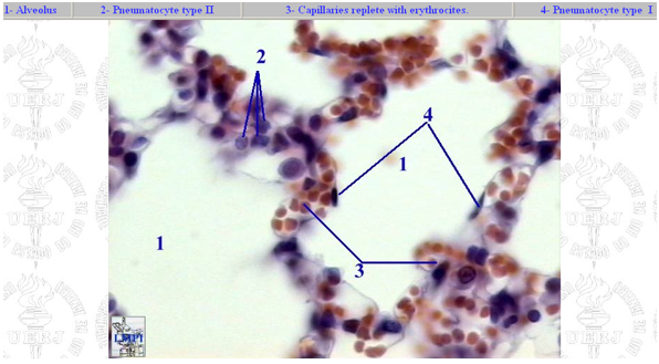 <p>Alveoli</p>