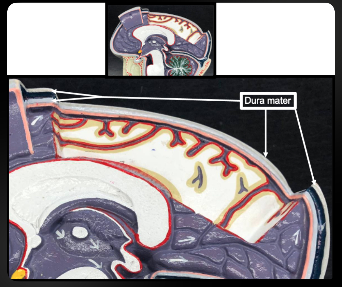 <p>Dura Mater (Brain)</p>