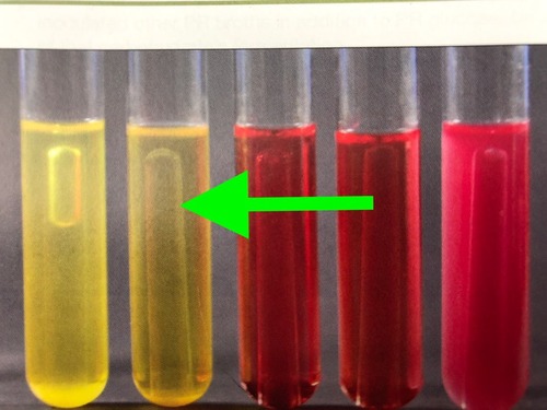 <p>Fermentation → acid produced.</p>