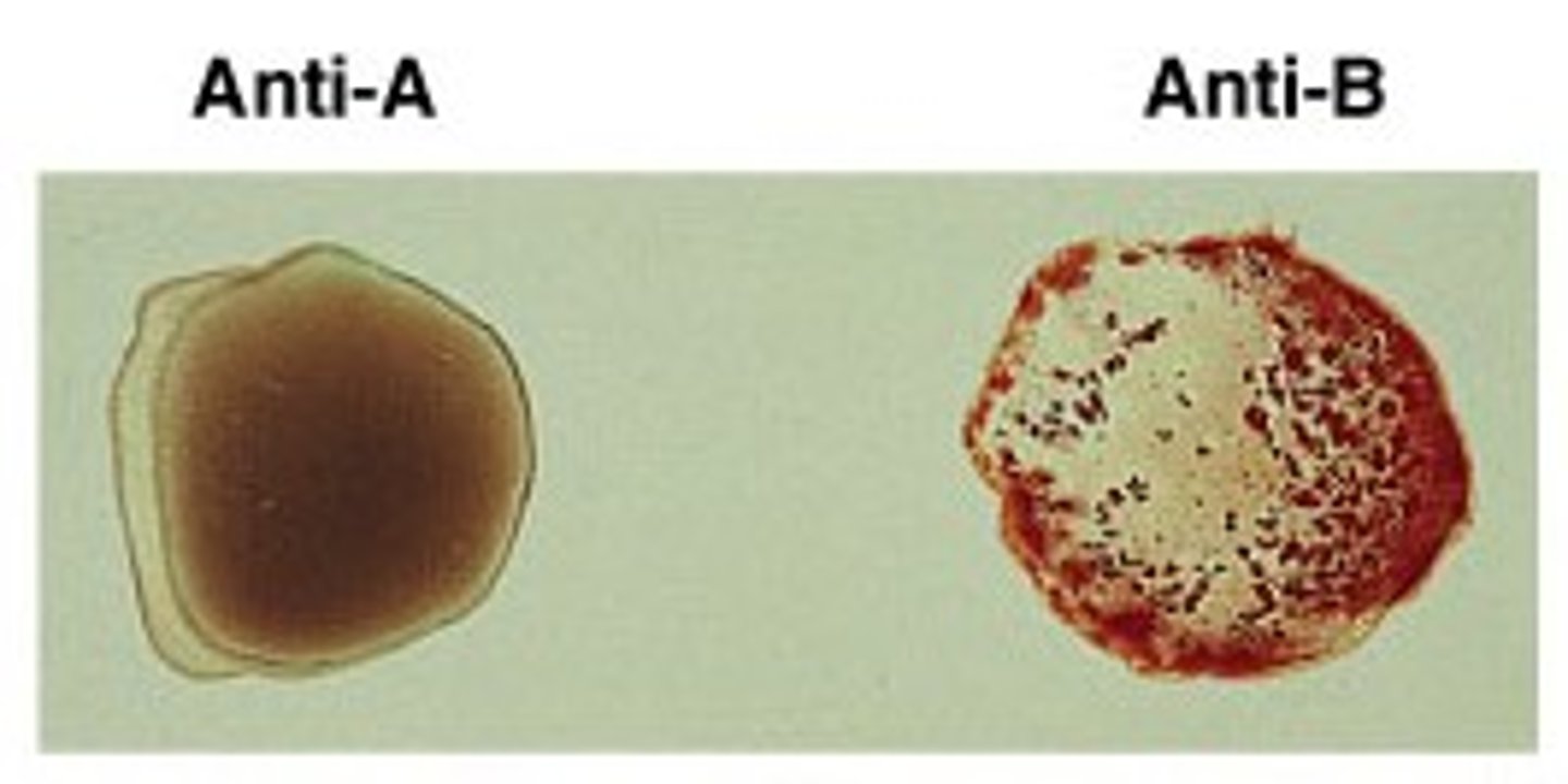 <p>What blood type is shown?</p>