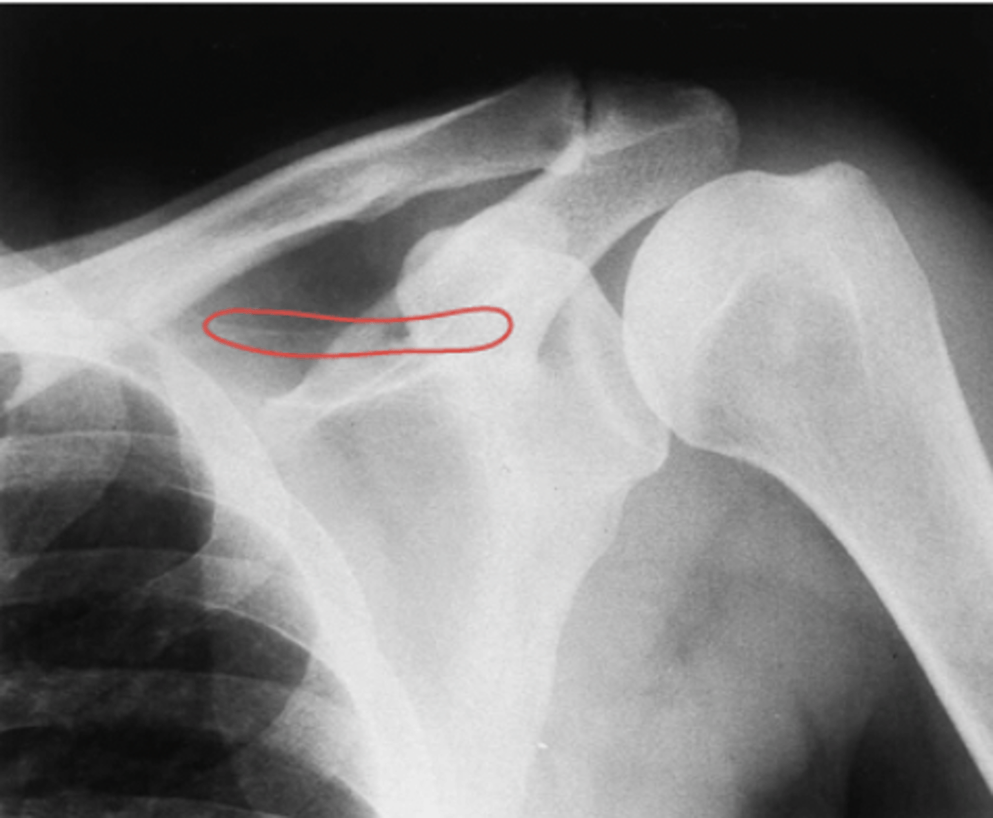 <p>What structure is highlighted?</p>