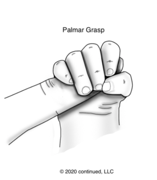 <p>palmar grasp</p>