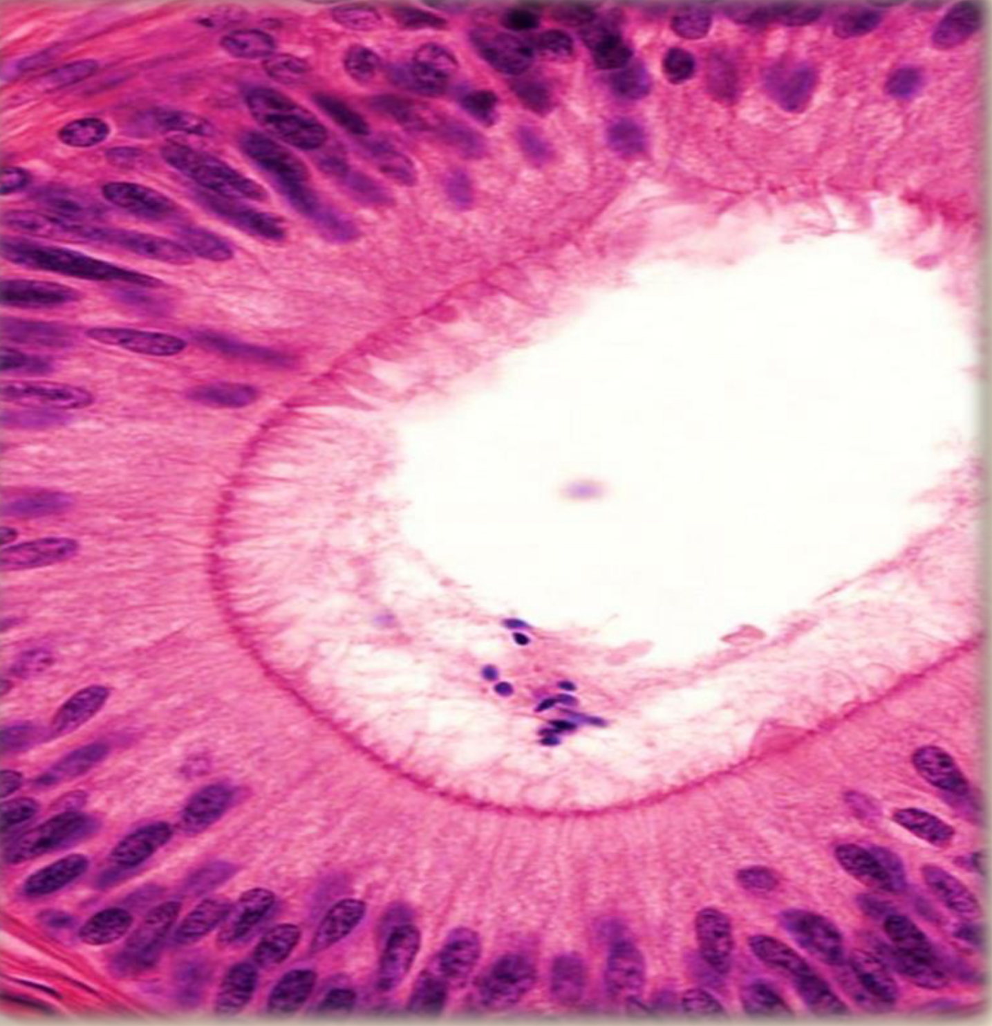 term image
