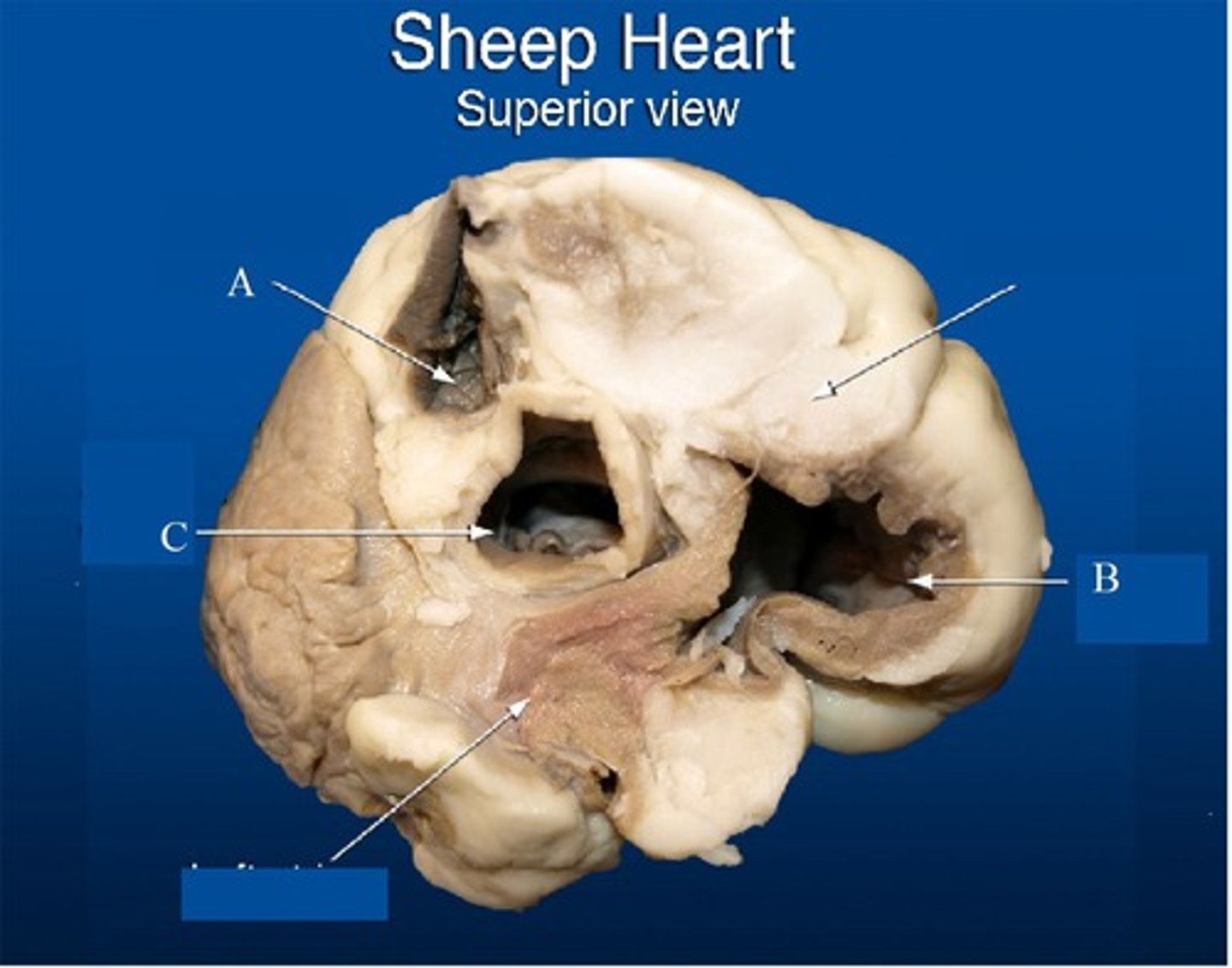 <p>B</p>