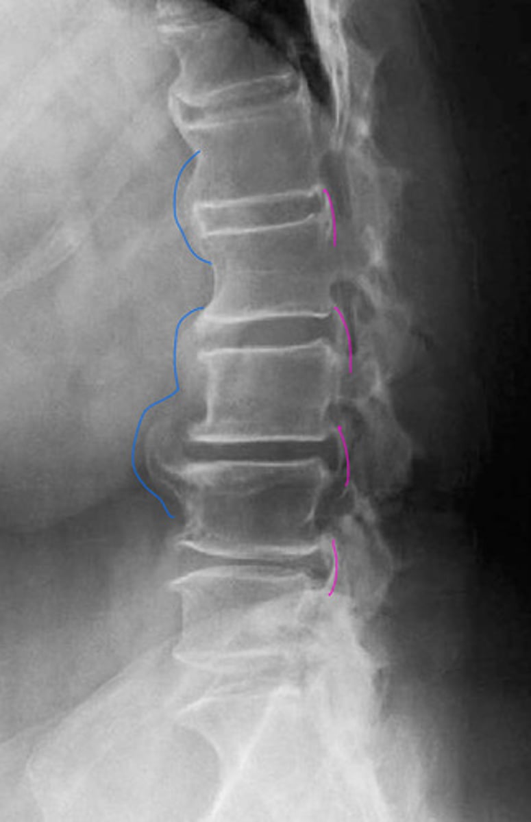 <p>What is the blue?</p><p>What is the pink?</p>