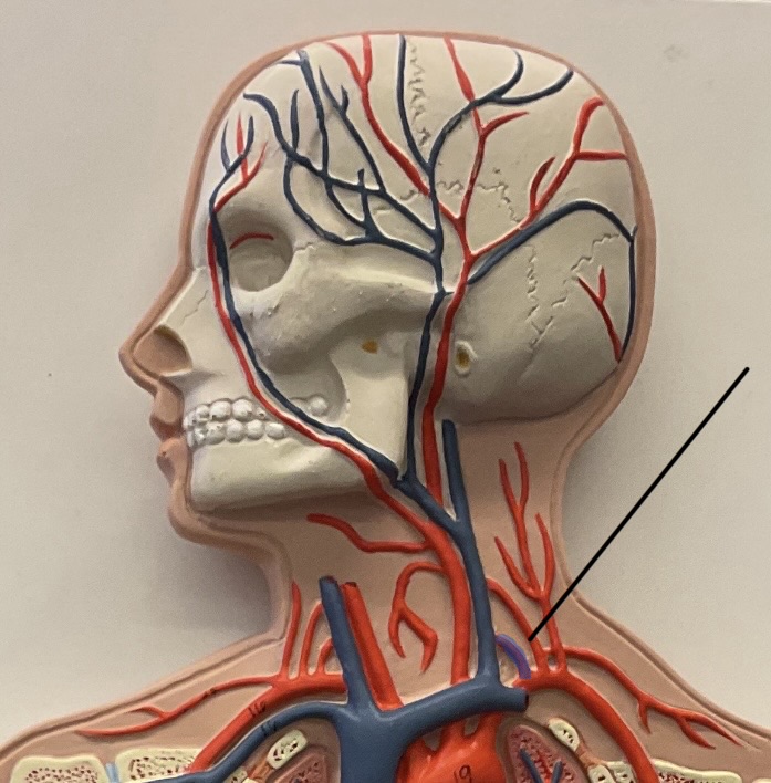 <p>Name this artery that feeds into the brain.</p>